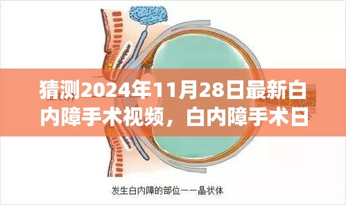 白内障手术最新进展揭秘，温馨之旅中的小惊喜，白内障手术日精彩瞬间回顾（附最新视频）