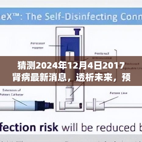 透析未来揭秘，肾病领域最新进展与动态分析预测至2024年展望（透析技术、新药研发等）