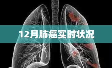 肺癌最新实时状况，了解与预防