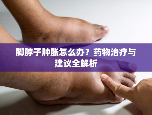 脚脖子肿胀怎么办？药物治疗与建议全解析